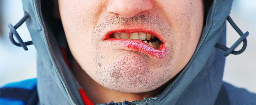 SD Dry Mouth Causes, Symptoms, and Remedies