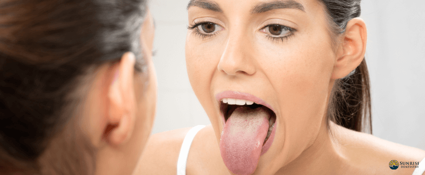 SD-woman checking her tongue