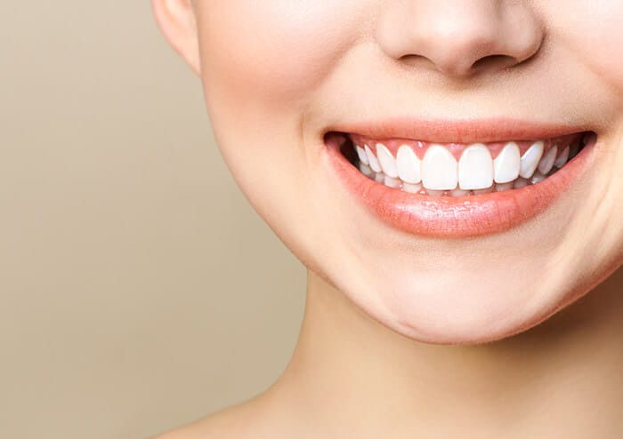 SD Woman Naturally Smiling Showing White Set of Teeth