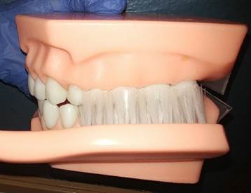 SD Teeth Scale Model being brushed with scale model of toothbrush