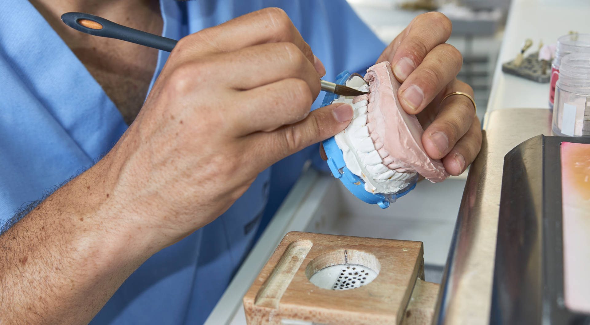 SD Dentist creating mold for restorative dentistry
