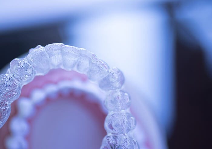 SD Close up of Oral Appliance